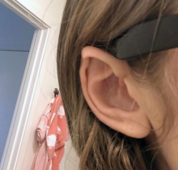 На этих фото показали, какие финты генетика вытворяет с людьми На этих фото показали, какие финты генетика вытворяет с людьми