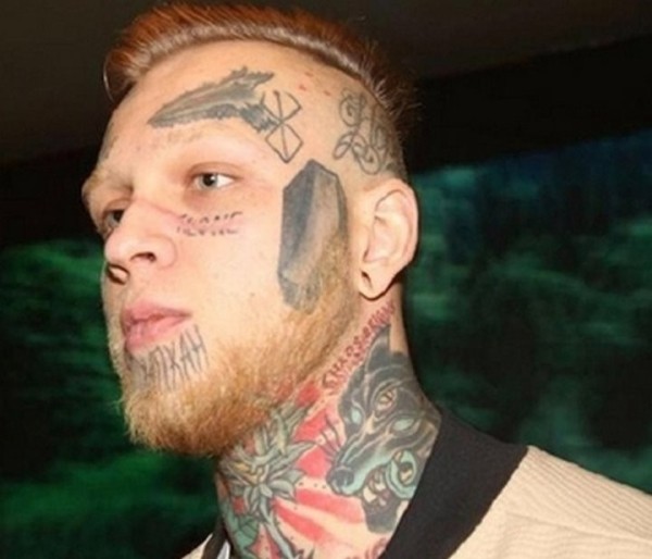Как выглядит лицо после удаления татуировки Как выглядит лицо после удаления татуировки