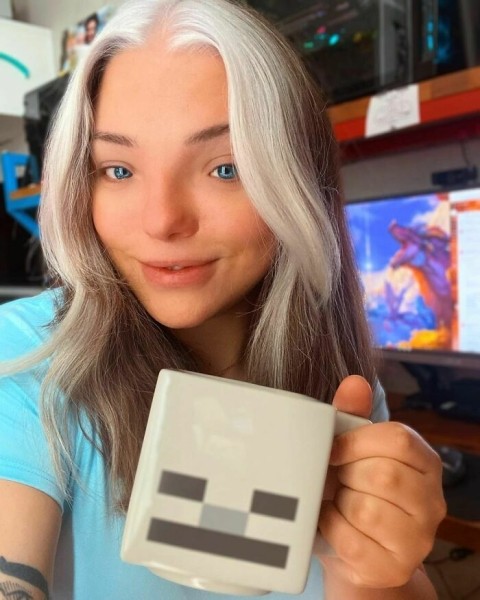 На этих фото показали, какие финты генетика вытворяет с людьми На этих фото показали, какие финты генетика вытворяет с людьми