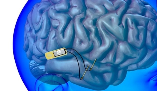 Учёные создали живого радиоуправляемого голубя Учёные создали живого радиоуправляемого голубя